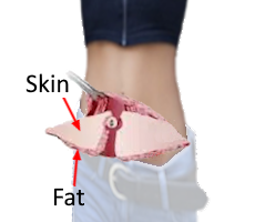 model with cross section of abdominal skin and fat